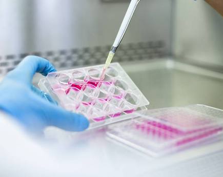 Pipet en well-plaat met celkweek, beeld van het HAN-lectoraat Drug Discovery.